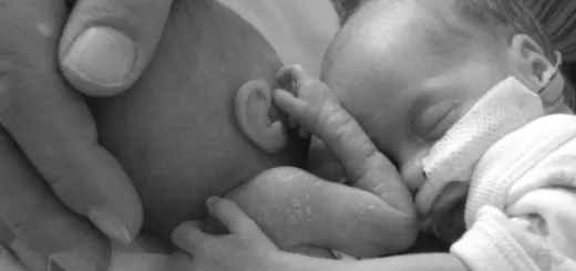 health-condition-baby-heavy-400g-improved-twin-sister-placed-next